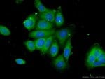 Thumbnail_C6orf211 Rabbit anti-Human, Polyclonal, Proteintech 20 &mu;L; Unconjugated:Anticuerpos