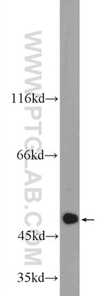 Thumbnail_C6orf211 Rabbit anti-Human, Polyclonal, Proteintech 20 &mu;L; Unconjugated:Anticuerpos