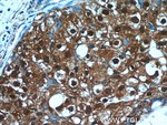 Thumbnail_C6orf211 Rabbit anti-Human, Polyclonal, Proteintech 20 &mu;L; Unconjugated:Anticuerpos