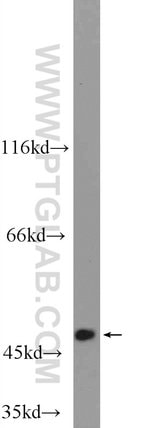 Thumbnail_C6orf211 Rabbit anti-Human, Polyclonal, Proteintech 20 &mu;L; Unconjugated:Anticuerpos