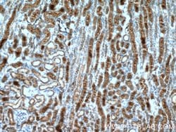 AQP7 Rabbit anti-Human, Mouse, Polyclonal, Proteintech:Antibodies:Primary