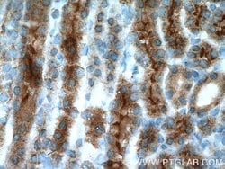 AQP7 Rabbit anti-Human, Mouse, Polyclonal, Proteintech:Antibodies:Primary