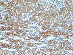 AQP7 Rabbit anti-Human, Mouse, Polyclonal, Proteintech:Antibodies:Primary