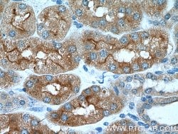 AQP7 Rabbit anti-Human, Mouse, Polyclonal, Proteintech:Antibodies:Primary