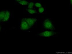 RNF38 Rabbit anti-Human, Polyclonal, Proteintech