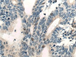 RNF38 Rabbit anti-Human, Polyclonal, Proteintech:Antikörper:Primärantikörper