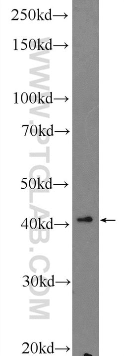 RNF38 Rabbit anti-Human, Polyclonal, Proteintech:Antikörper:Primärantikörper