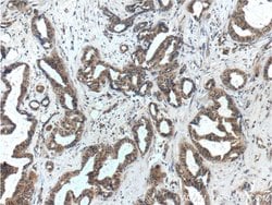 WDFY3 / ALFY Rabbit anti-Human, Polyclonal, Proteintech 20 &mu;L | Buy Online | Proteintech | Fisher Scientific