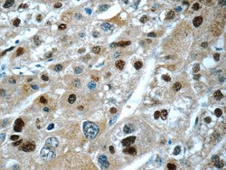 ONECUT1 Rabbit anti-Human, Mouse, Polyclonal, Proteintech:Antibodies:Primary