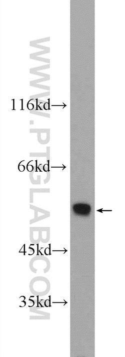 ONECUT1 Rabbit anti-Human, Mouse, Polyclonal, Proteintech:Antibodies:Primary