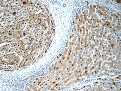 ONECUT1 Rabbit anti-Human, Mouse, Polyclonal, Proteintech:Antibodies:Primary