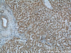 ONECUT1 Rabbit anti-Human, Mouse, Polyclonal, Proteintech:Antibodies:Primary