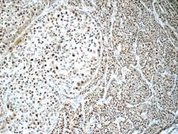 ONECUT1 Rabbit anti-Human, Mouse, Polyclonal, Proteintech:Antibodies:Primary
