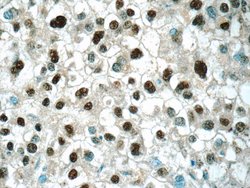 ONECUT1 Rabbit anti-Human, Mouse, Polyclonal, Proteintech:Antibodies:Primary