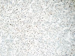 ONECUT1 Rabbit anti-Human, Mouse, Polyclonal, Proteintech:Antibodies:Primary