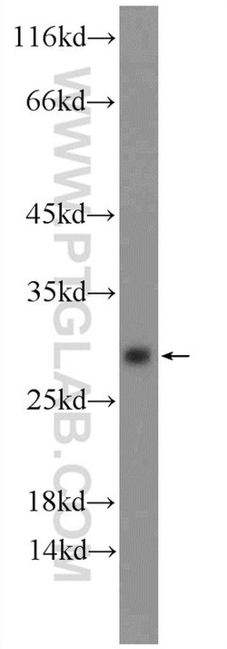BHLHA15 Rabbit anti-Human, Mouse, Rat, Polyclonal, Proteintech 150 &mu;L;