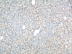 ZNF326 Rabbit anti-Human, Mouse, Polyclonal, Proteintech:Antibodies:Primary