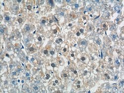 ZNF326 Rabbit anti-Human, Mouse, Polyclonal, Proteintech:Antibodies:Primary