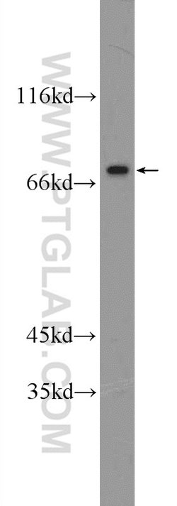 ZNF326 Rabbit anti-Human, Mouse, Polyclonal, Proteintech:Antibodies:Primary