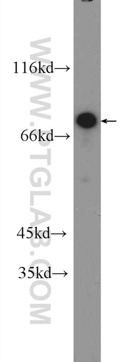 ZNF326 Rabbit anti-Human, Mouse, Polyclonal, Proteintech:Antibodies:Primary
