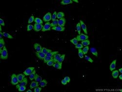PROSC Rabbit anti-Human, Polyclonal, Proteintech:Antibodies:Primary Antibodies