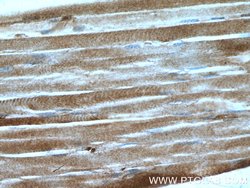 PROSC Rabbit anti-Human, Polyclonal, Proteintech:Antibodies:Primary Antibodies