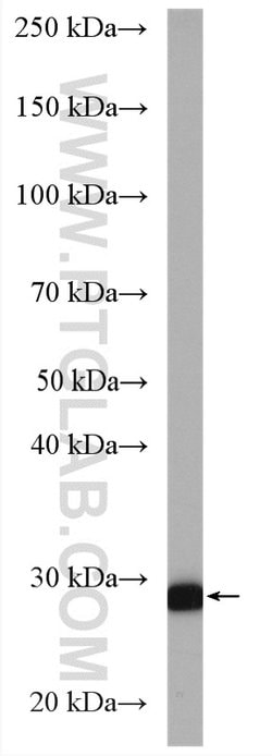 PROSC Rabbit anti-Human, Polyclonal, Proteintech:Antibodies:Primary Antibodies