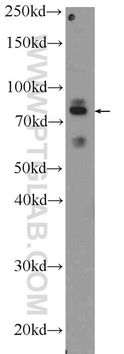 PTCD3 Rabbit anti-Human, Mouse, Rat, Polyclonal, Proteintech:Antibodies:Primary