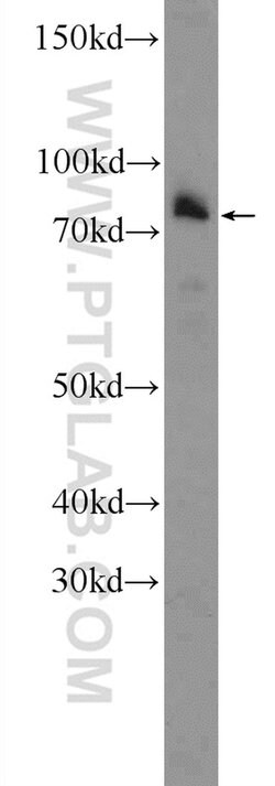 PTCD3 Rabbit anti-Human, Mouse, Rat, Polyclonal, Proteintech:Antibodies:Primary