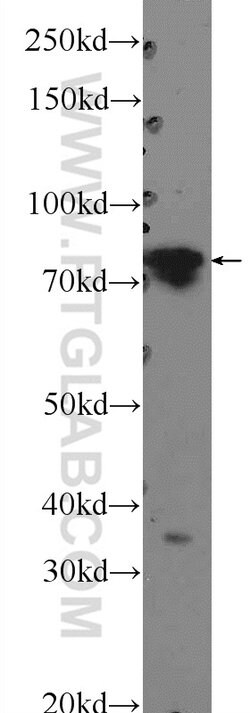 PTCD3 Rabbit anti-Human, Mouse, Rat, Polyclonal, Proteintech:Antibodies:Primary