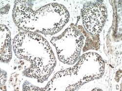 HIVEP1 Rabbit anti-Human, Polyclonal, Proteintech 150 &mu;L; Unconjugated:Antibodies,