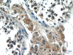HIVEP1 Rabbit anti-Human, Polyclonal, Proteintech 150 &mu;L; Unconjugated:Antibodies,