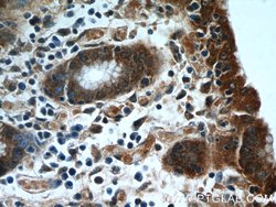 HIVEP1 Rabbit anti-Human, Polyclonal, Proteintech 150 &mu;L; Unconjugated:Antibodies,