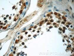 HIVEP1 Rabbit anti-Human, Polyclonal, Proteintech 150 &mu;L; Unconjugated:Antibodies,