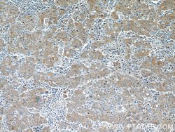 Glypican 3 Rabbit anti-Human, Polyclonal, Proteintech:Antibodies:Primary