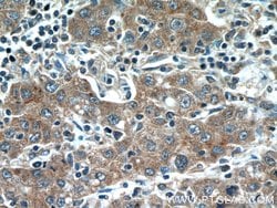 Glypican 3 Rabbit anti-Human, Polyclonal, Proteintech:Antibodies:Primary