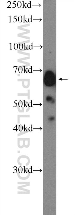 Glypican 3 Rabbit anti-Human, Polyclonal, Proteintech:Antibodies:Primary