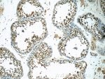 Thumbnail_ZNF497 Rabbit anti-Human, Mouse, Polyclonal, Proteintech 20 &mu;L; Unconjugated:Antibodies,