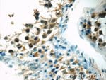 Thumbnail_ZNF497 Rabbit anti-Human, Mouse, Polyclonal, Proteintech 20 &mu;L; Unconjugated:Antibodies,