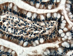 FBP2 Rabbit anti-Human, Mouse, Polyclonal, Proteintech:Antibodies:Primary