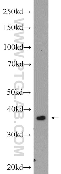 FBP2 Rabbit anti-Human, Mouse, Polyclonal, Proteintech:Antibodies:Primary