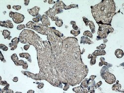 KIAA0125 Rabbit anti-Human, Polyclonal, Proteintech:Antibodies:Primary