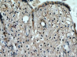 KIAA0125 Rabbit anti-Human, Polyclonal, Proteintech:Antibodies:Primary