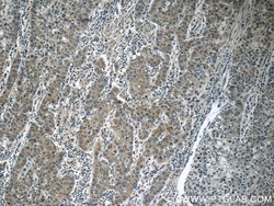 KIAA0125 Rabbit anti-Human, Polyclonal, Proteintech:Antibodies:Primary