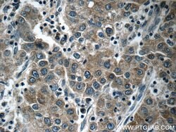 KIAA0125 Rabbit anti-Human, Polyclonal, Proteintech:Antibodies:Primary