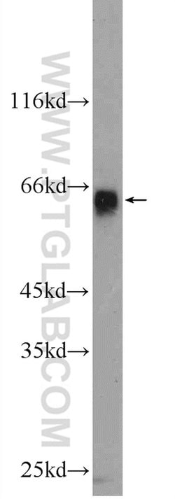 ZIM3 Rabbit anti-Human, Polyclonal, Proteintech:Antibodies:Primary Antibodies