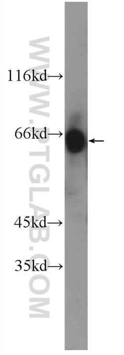 ZIM3 Rabbit anti-Human, Polyclonal, Proteintech:Antibodies:Primary Antibodies