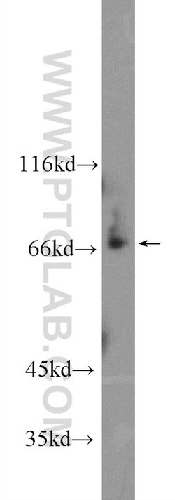 ZKSCAN1 Rabbit anti-Human, Mouse, Polyclonal, Proteintech:Antibodies:Primary