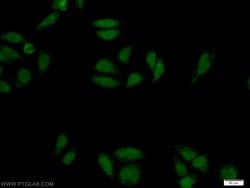 ZNF124 Rabbit anti-Human, Polyclonal, Proteintech 150 &mu;L; Unconjugated:Antibodies,