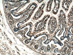 USE1 Rabbit anti-Human, Polyclonal, Proteintech:Antibodies:Primary Antibodies